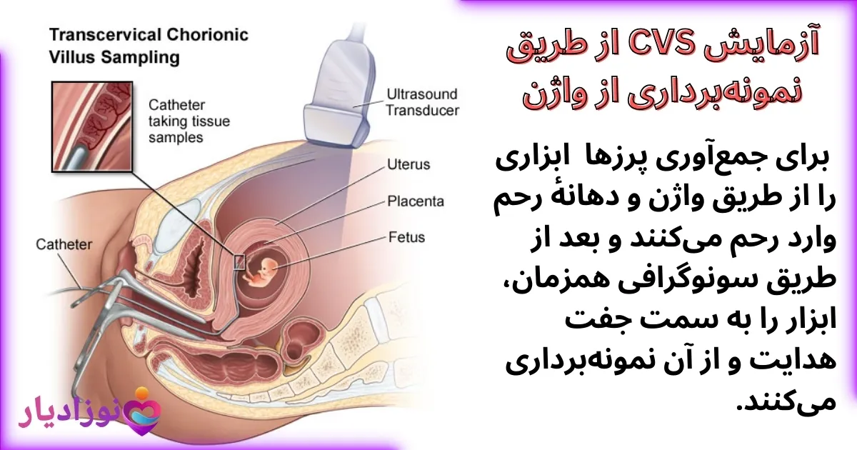 آزمایش cvs