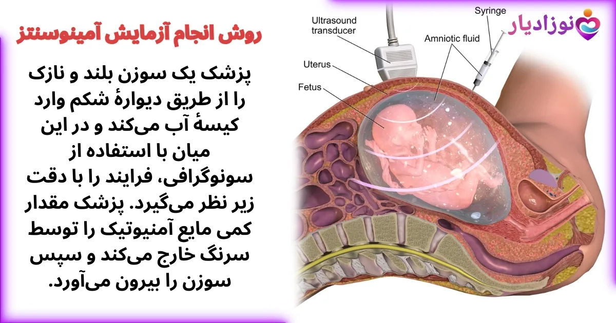 روش انجام آزمایش آمینوسنتز