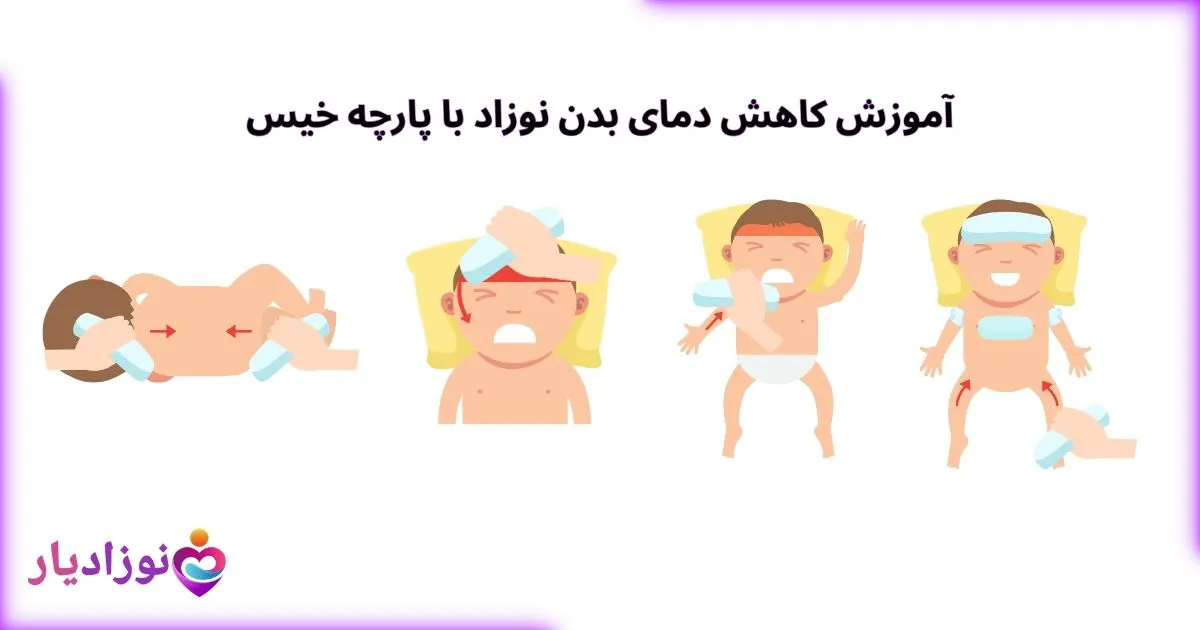 آموزش کاهش دمای بدن نوزاد با پارچه خیس